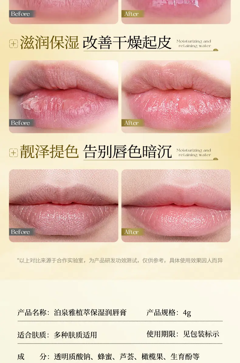 Moisturizing lip balm, unisex — chobi 30